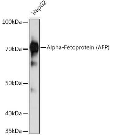 Alpha-Fetoprotein (AFP) Mouse Monoclonal Antibody
