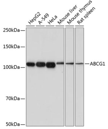 ABCG1 Rabbit Monoclonal Antibody