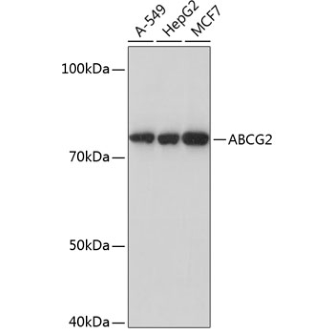 ABCG2 Rabbit Monoclonal Antibody