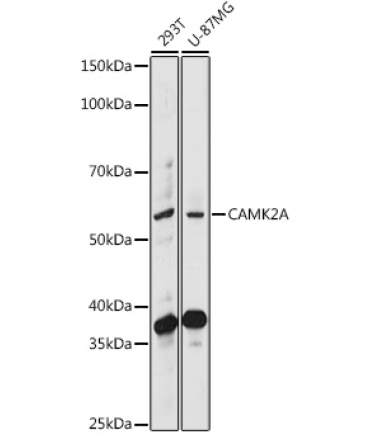 CAMK2A Rabbit Polyclonal Antibody
