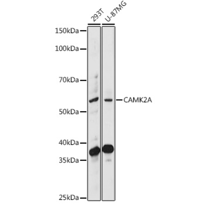 CAMK2A Rabbit Polyclonal Antibody