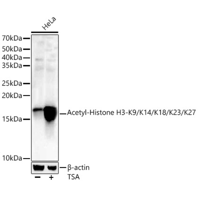Acetyl-Histone H3-K9/K14/K18/K23/K27 Rabbit Polyclonal Antibody