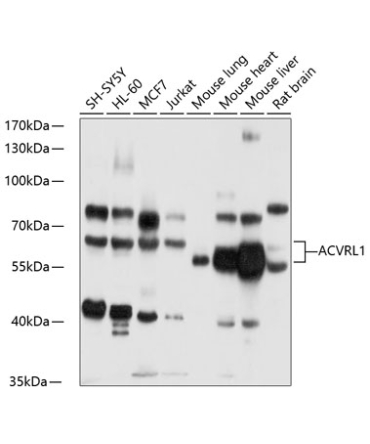 ACVRL1 Rabbit Polyclonal Antibody