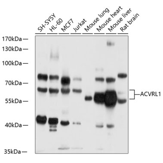 ACVRL1 Rabbit Polyclonal Antibody