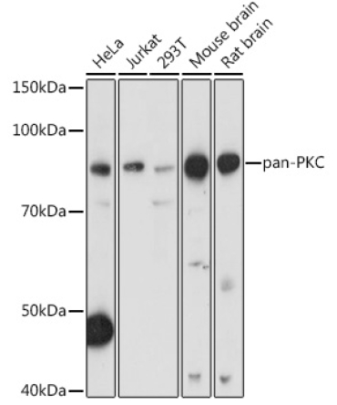 pan-PKC Rabbit Polyclonal Antibody