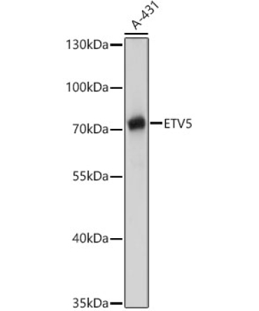 ETV5 Rabbit Polyclonal Antibody