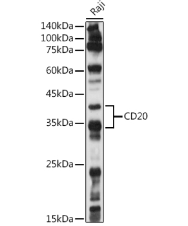 CD20 Rabbit Polyclonal Antibody