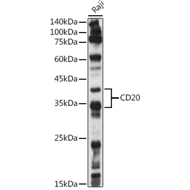 CD20 Rabbit Polyclonal Antibody