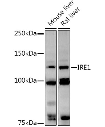 IRE1 Rabbit Polyclonal Antibody
