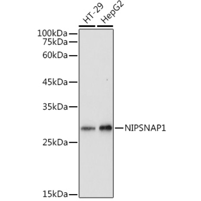 NIPSNAP1 Rabbit Polyclonal Antibody