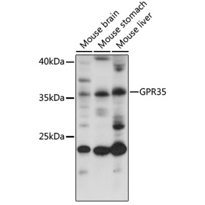 GPR35 Rabbit Polyclonal Antibody