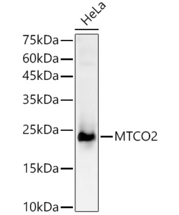 MTCO2 Rabbit Polyclonal Antibody