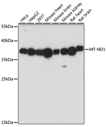 MT-ND1 Rabbit Polyclonal Antibody