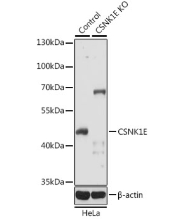 CSNK1E Rabbit Polyclonal Antibody [KO Validated]