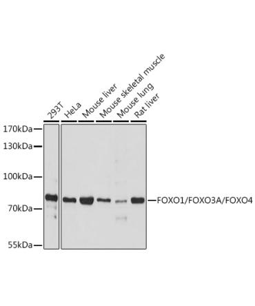 FOXO1/FOXO3A/FOXO4 Rabbit Polyclonal Antibody