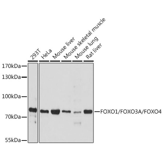FOXO1/FOXO3A/FOXO4 Rabbit Polyclonal Antibody