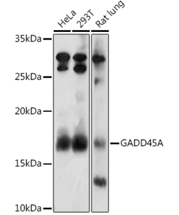 GADD45A Rabbit Polyclonal Antibody