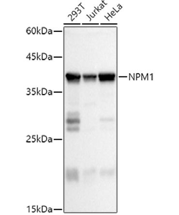 NPM1 Rabbit Polyclonal Antibody