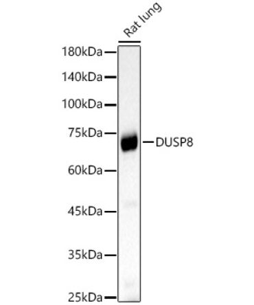 DUSP8 Rabbit Polyclonal Antibody