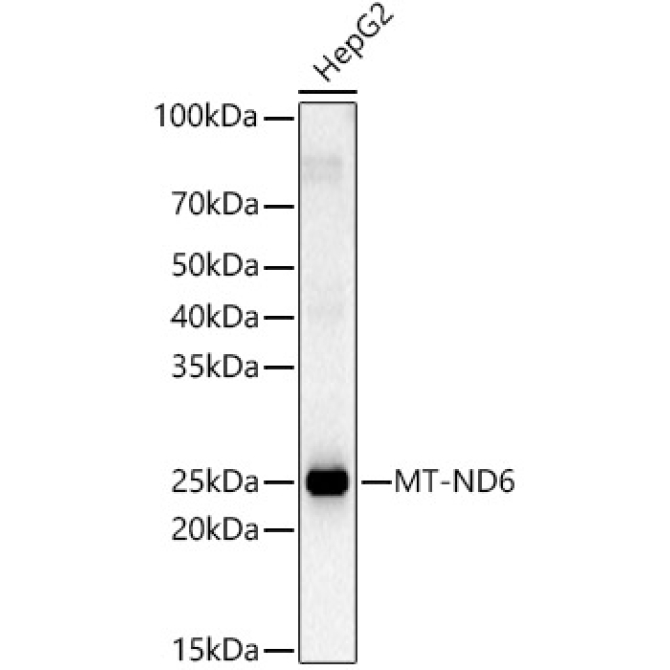 MT-ND6 Rabbit Polyclonal Antibody