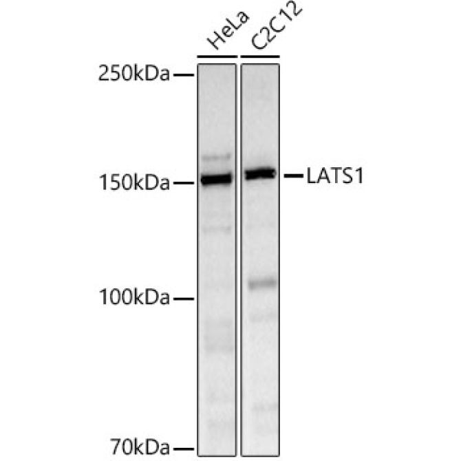 LATS1 Rabbit Polyclonal Antibody