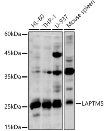 LAPTM5 Rabbit Polyclonal Antibody