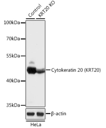 Cytokeratin 20 (KRT20) Rabbit Polyclonal Antibody [KO Validated]