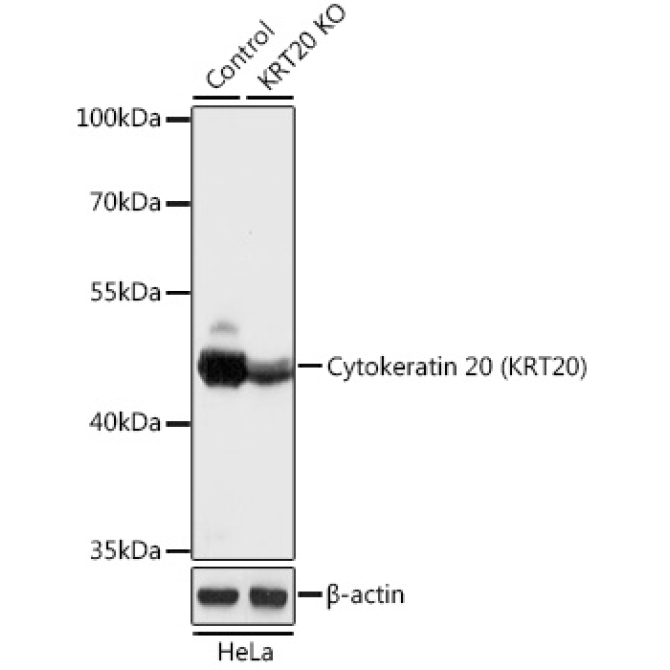 Cytokeratin 20 (KRT20) Rabbit Polyclonal Antibody [KO Validated]