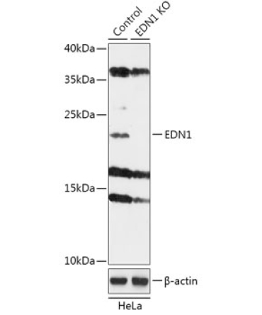 EDN1 Rabbit Polyclonal Antibody [KO Validated]