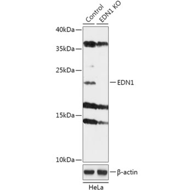 EDN1 Rabbit Polyclonal Antibody [KO Validated]