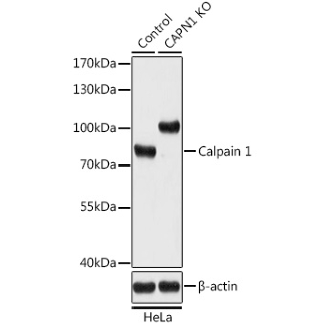 Calpain 1 Rabbit Polyclonal Antibody [KO Validated]