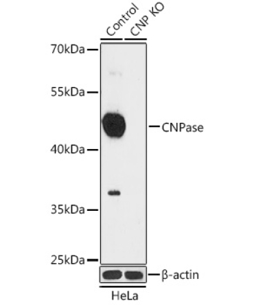 CNPase Rabbit Polyclonal Antibody [KO Validated]