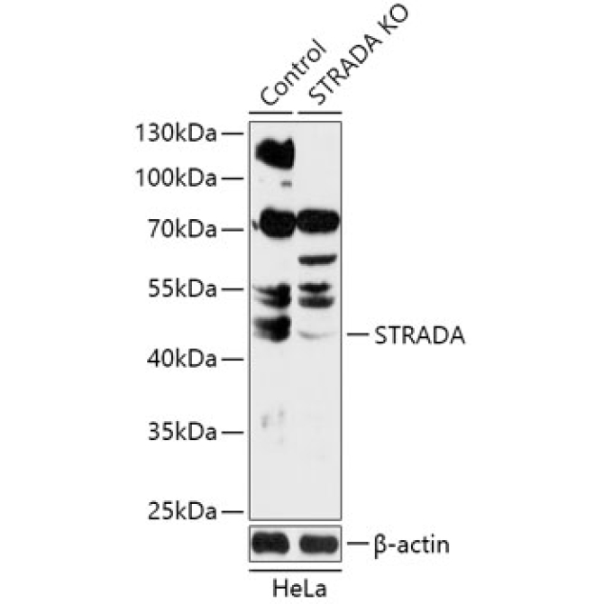 STRADA Rabbit Polyclonal Antibody [KO Validated]