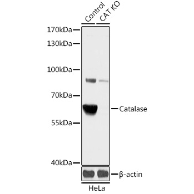 Catalase Rabbit Polyclonal Antibody [KO Validated]