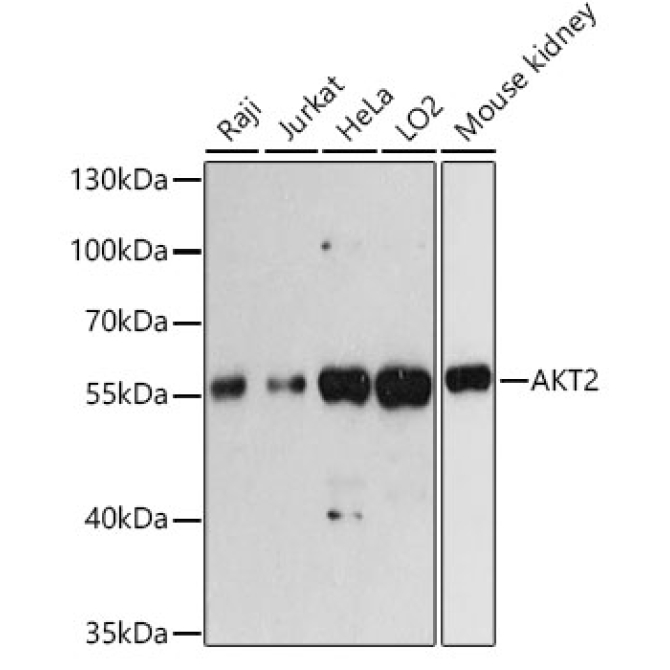 AKT2 Rabbit Polyclonal Antibody