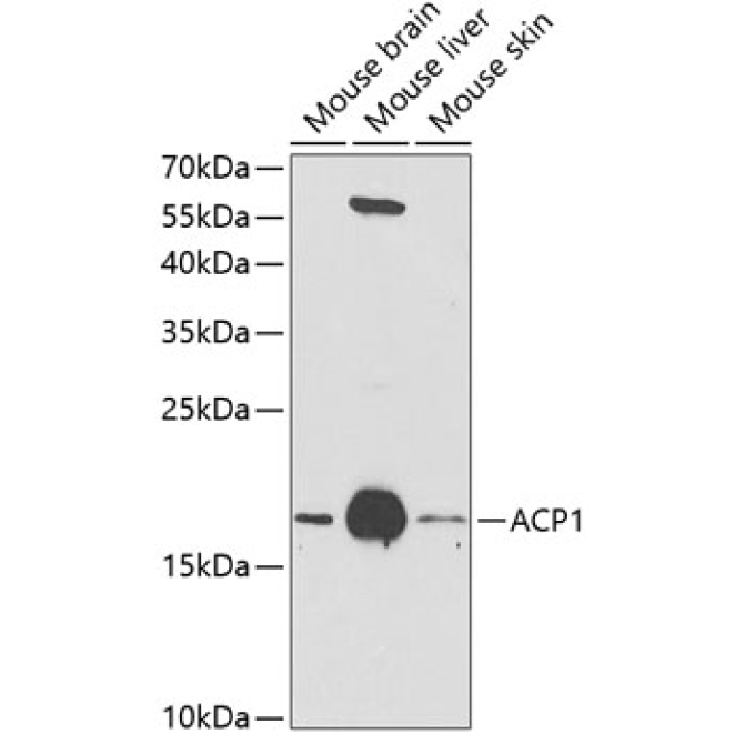 ACP1 Rabbit Polyclonal Antibody