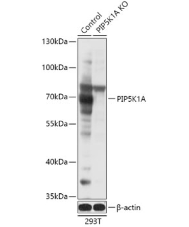 PIP5K1A Rabbit Polyclonal Antibody [KO Validated]