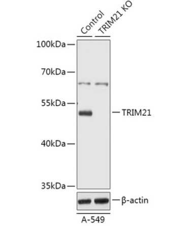TRIM21/SS-A Rabbit Polyclonal Antibody [KO Validated]