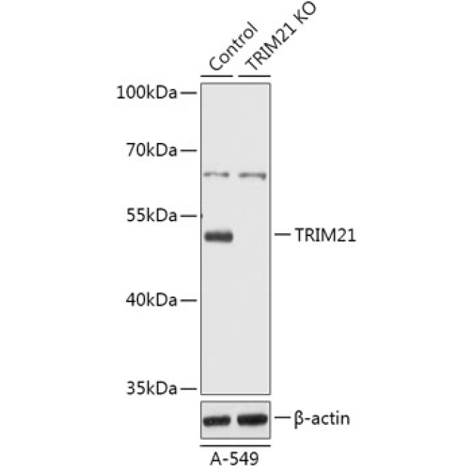 TRIM21/SS-A Rabbit Polyclonal Antibody [KO Validated]
