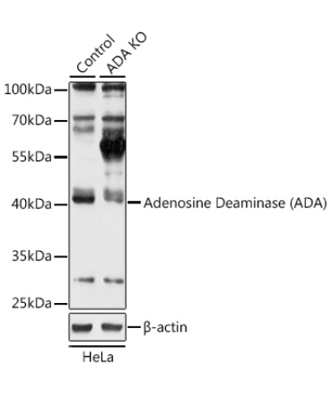 Adenosine Deaminase (ADA) Rabbit Polyclonal Antibody [KO Validated]