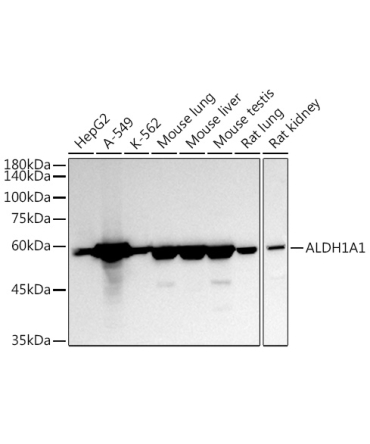 ALDH1A1 Rabbit Polyclonal Antibody