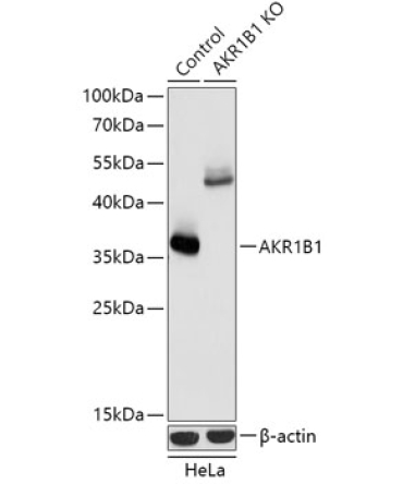 AKR1B1 Rabbit Polyclonal Antibody [KO Validated]