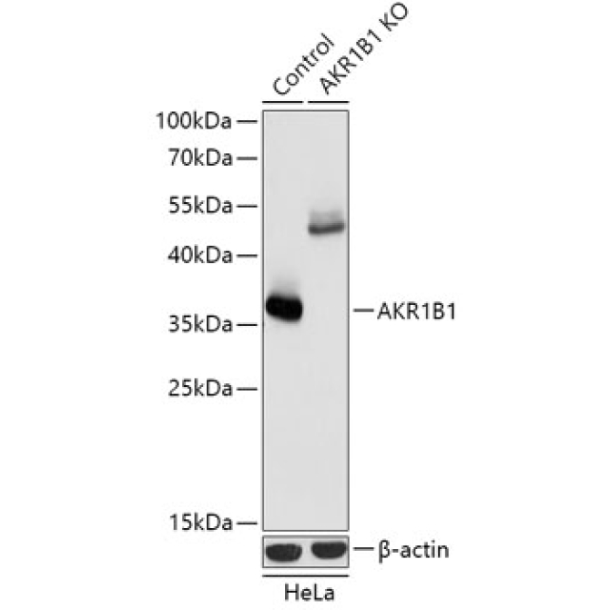 AKR1B1 Rabbit Polyclonal Antibody [KO Validated]