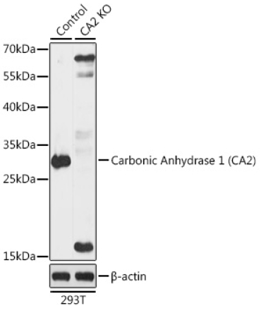 Carbonic Anhydrase 2 (CA2) Rabbit Polyclonal Antibody [KO Validated]