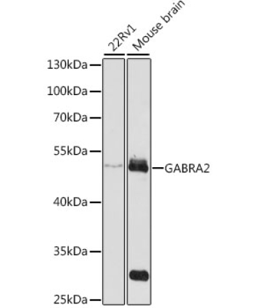 GABRA2 Rabbit Polyclonal Antibody