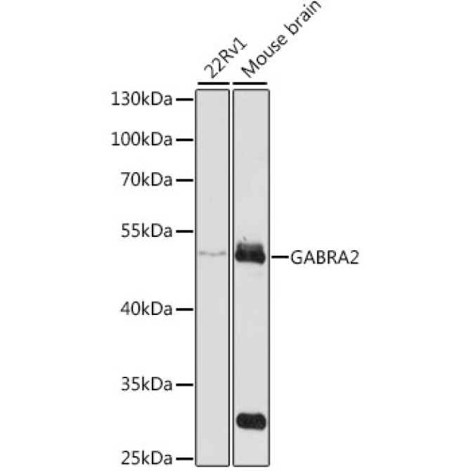 GABRA2 Rabbit Polyclonal Antibody