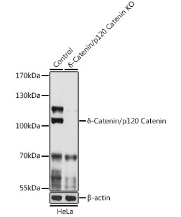 Delta-Catenin/p120 Catenin Rabbit Polyclonal Antibody [KO Validated]