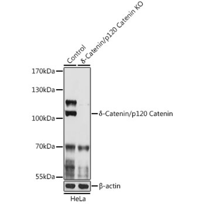 Delta-Catenin/p120 Catenin Rabbit Polyclonal Antibody [KO Validated]