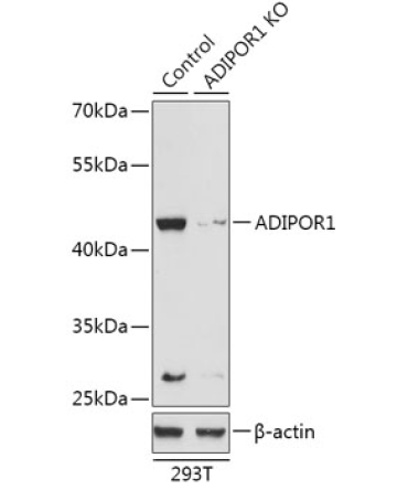 ADIPOR1 Rabbit Polyclonal Antibody [KO Validated]