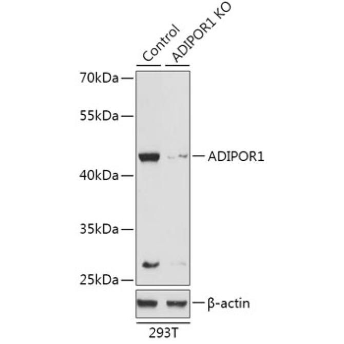ADIPOR1 Rabbit Polyclonal Antibody [KO Validated]